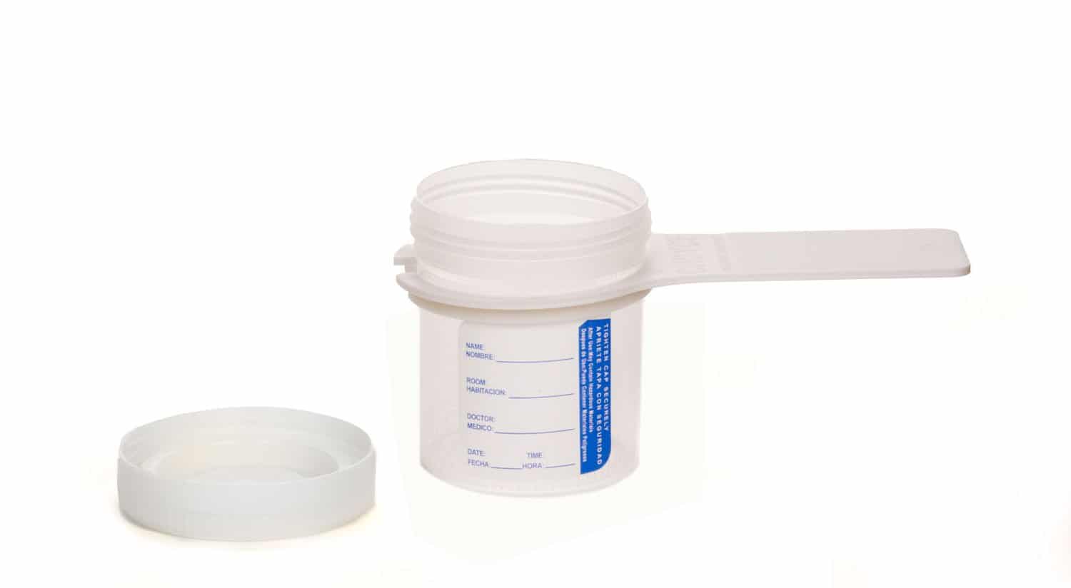 Urine-Collection-Cup-with-Easy-Hold-Handle